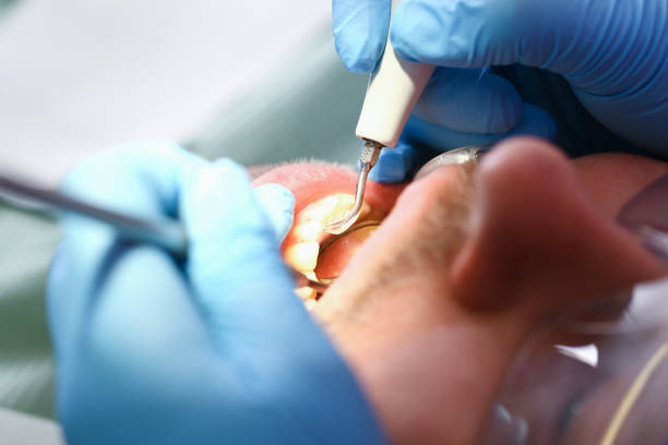 Best Emergency Orthodontic Repairs in Bluffton, OH